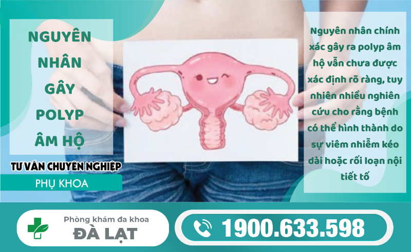 Hình ảnh minh họa